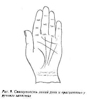 Рис. 9. Совокупность линий руки и "расцетты" у ручного запястья.