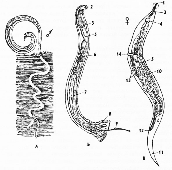 Рис. 154. Нематоды - паразиты кишечника человека: А - власоглав Trichocephalus trichiurus (no Клаусу), В - свайник Ancytostoma duodenate (no Брауну), В - детская острица Enterobius vermicularis (по Брауну); 1 - рот, 2 - ротовая полость с зубами, 3 - пищевод, 4 - зоб, 5 - средняя кишка, 6 - семенник, 7 - семяизвергательный канал, 8 - половая бурса, 9 - спикулы, 10 - яичник, 11 - хвост, 12 - анус, 13 - матка, 14 - половое отверстие