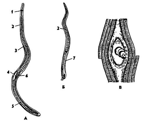 Рис. 155. Трихинелла спиральная Trichmella spiralis А - самка, Б - самец, В - личинка в мышцах (по Лейкарту и Клаусу): 1 - нервное кольцо, 2 - клетки пищевода, 3 - женское половое отверстие, 4 - матка, 5 - яичник, 6 - средняя кишка, 7 – семенник